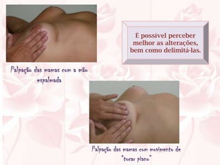 É possível perceber
                                               melhor as alterações,
                                              bem como delimitá-las.


Palpação das mamas com a mão
          espalmada




                               Palpação das mamas com movimento de
                                           “tocar piano”
 
