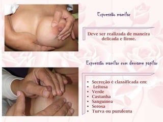 Expressão mamilar


Deve ser realizada de maneira
      delicada e firme.




Expressão mamilar com derrame papilar

   Secreção é classificada em:
    Leitosa
   Verde
   Castanha
   Sanguínea
   Serosa
   Turva ou purulenta
 