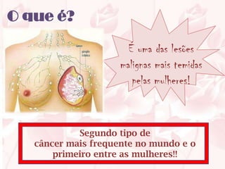 O que é?

                       É uma das lesões
                     malignas mais temidas
                        pelas mulheres!


            Segundo tipo de
   câncer mais frequente no mundo e o
       primeiro entre as mulheres!!
 