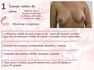 1   Inspeção estática das
    mamas usuária mantenha
               Solicitar que a

               os braços relaxados
                e rentes ao corpo.

       Observar e registrar:


a simetria, estado da pele (aspecto de “casca de laranja”, feridas
que não cicatrizam), estado da aréola e mamilo, tônus muscular;


Formato das mamas: arredondada, pendular, cônicas;


Tamanho das mamas: médio, pequeno e grande


Tipo: grau I criança, grau II adolescente, grau III adulto e
grau IV grande.
 