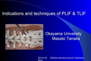2010.9.30 　 AOSpine Advance Course Yokohama 2010 Indications and techniques of PLIF & TLIF 　 Okayama University  Masato Tanaka 　 