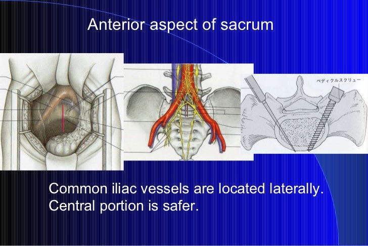 Where can i buy ivermectin for head lice