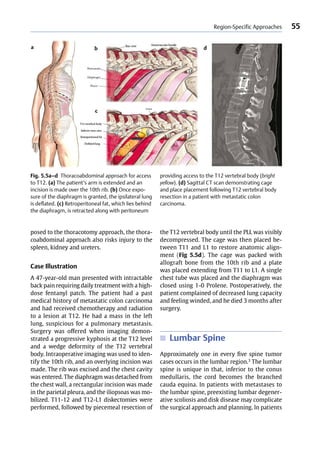 Ao spine masters series volume 1 metastatic spinal tumors | PDF