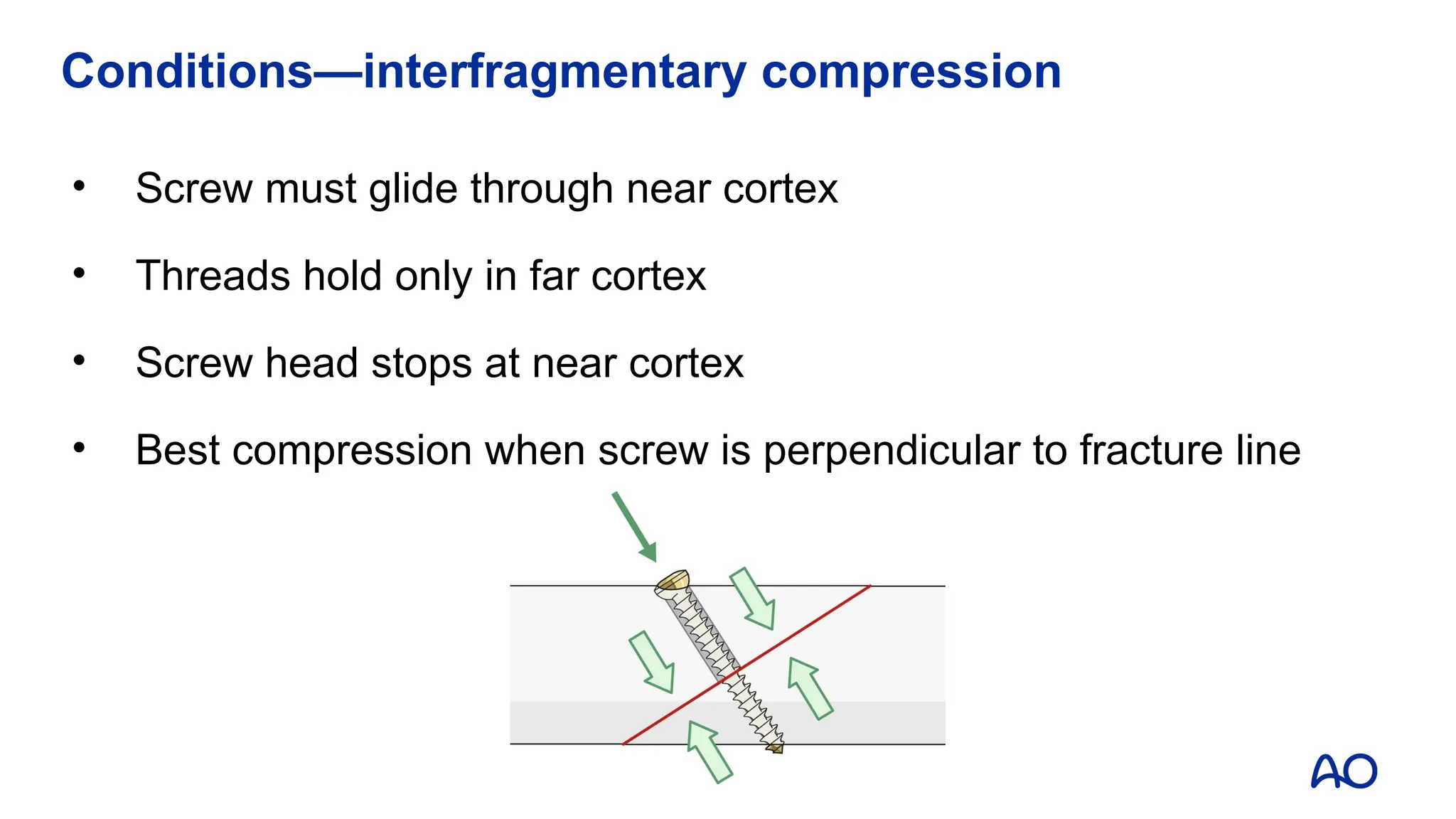 • Screw must glide through near cortex
• Threads hold only in far cortex
• Screw head stops at near cortex
• Best compression when screw is perpendicular to fracture line
Conditions—interfragmentary compression
 