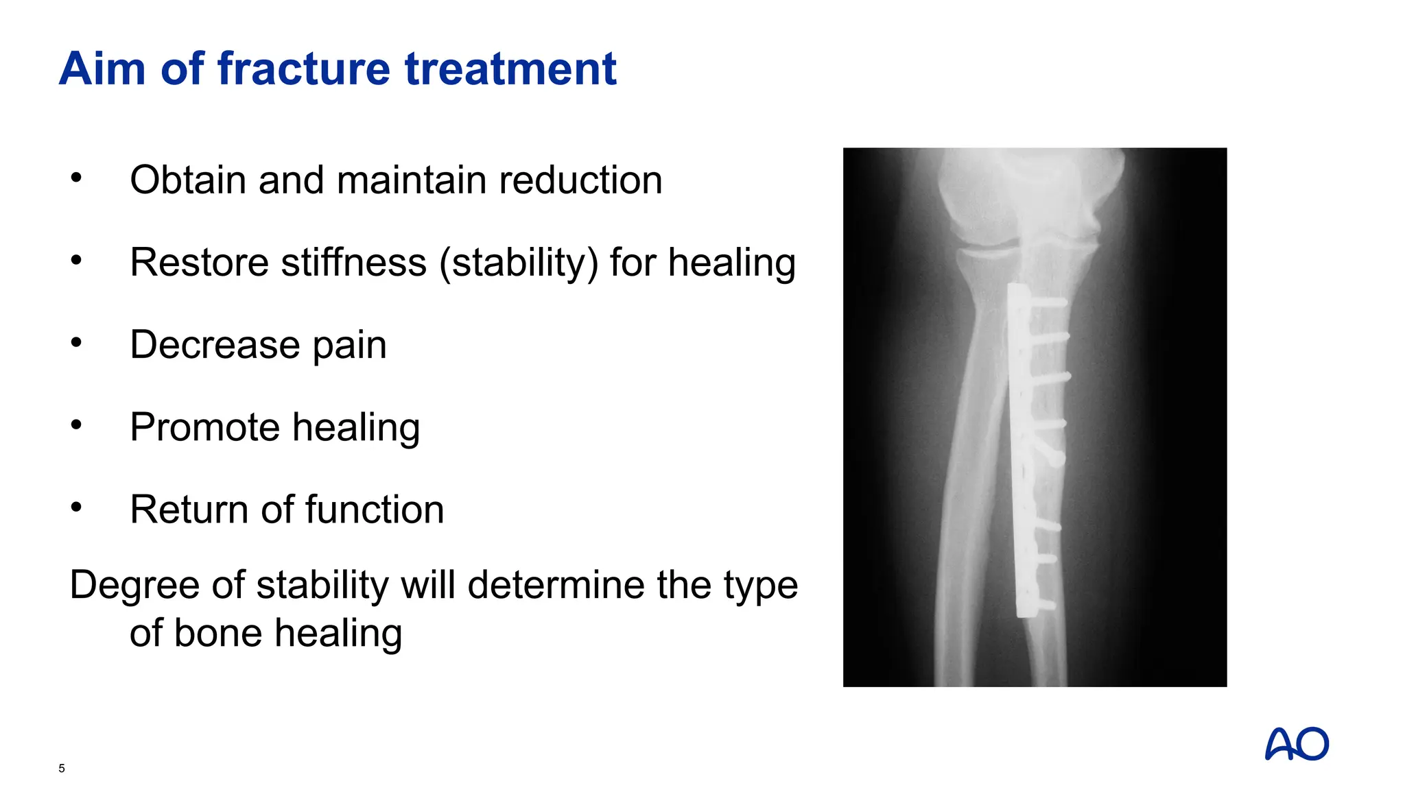 Aim of fracture treatment
5
• Obtain and maintain reduction
• Restore stiffness (stability) for healing
• Decrease pain
• Promote healing
• Return of function
Degree of stability will determine the type
of bone healing
 