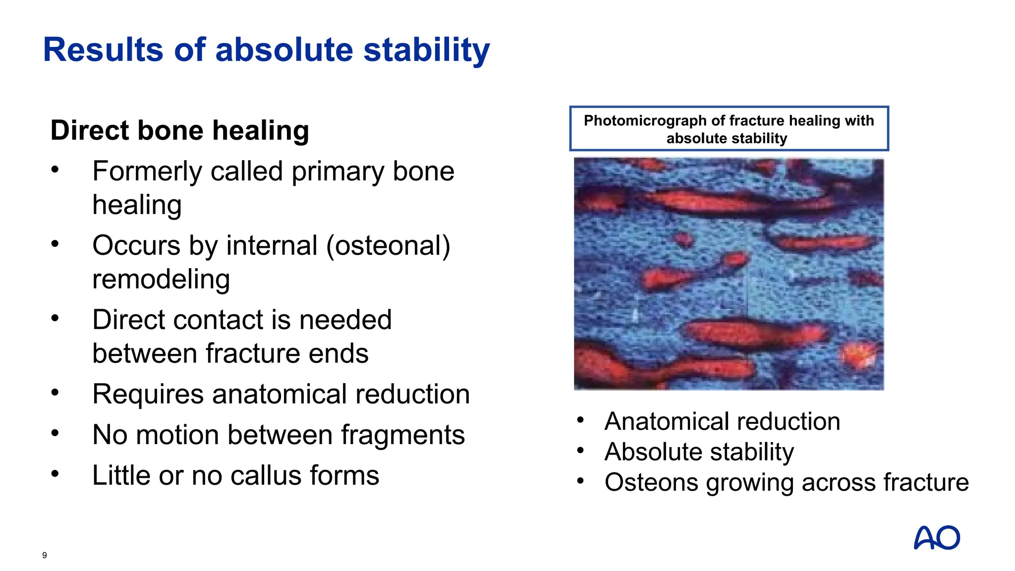 Results of absolute stability
Direct bone healing
• Formerly called primary bone
healing
• Occurs by internal (osteonal)
remodeling
• Direct contact is needed
between fracture ends
• Requires anatomical reduction
• No motion between fragments
• Little or no callus forms
9
• Anatomical reduction
• Absolute stability
• Osteons growing across fracture
Photomicrograph of fracture healing with
absolute stability
 