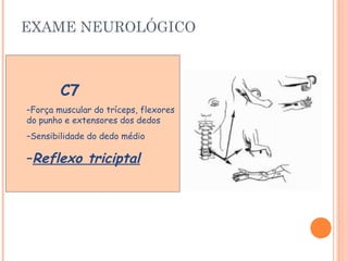 EXAME NEUROLÓGICO 
C7 
–Força muscular do tríceps, flexores 
do punho e extensores dos dedos 
–Sensibilidade do dedo médio 
–Reflexo triciptal 
 