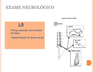 EXAME NEUROLÓGICO 
L5 
–Força muscular do extensor 
do hálux 
–Sensibilidade do dorso do pé 
 