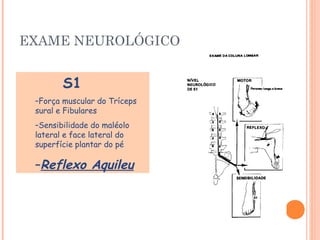 EXAME NEUROLÓGICO 
S1 
–Força muscular do Tríceps 
sural e Fibulares 
–Sensibilidade do maléolo 
lateral e face lateral do 
superfície plantar do pé 
–Reflexo Aquileu 
 