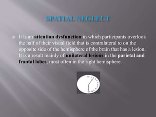  It is an attention dysfunction in which participants overlook
the half of their visual field that is contralateral to on the
opposite side of the hemisphere of the brain that has a lesion.
It is a result mainly of unilateral lesions in the parietal and
frontal lobes, most often in the right hemisphere.
 