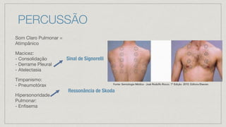 PERCUSSÃO
Som Claro Pulmonar =
Atimpânico
Macicez:
- Consolidação
- Derrame Pleural
- Atelectasia
Timpanismo:
- Pneumotórax
Hipersonoridade
Pulmonar:
- Enfisema
Ressonância de Skoda
Sinal de Signorelli
Fonte: Semiologia Médica - José Rodolfo Rocco. 1º Edição. 2010. Editora Elsevier.
 
