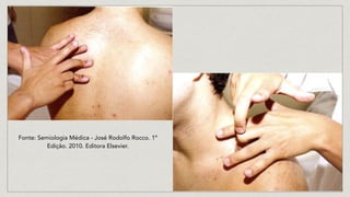 Fonte: Semiologia Médica - José Rodolfo Rocco. 1º
Edição. 2010. Editora Elsevier.
 