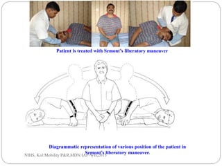 Semont R Bppv BPPV - Physical Diagnosis and Management | PPTX