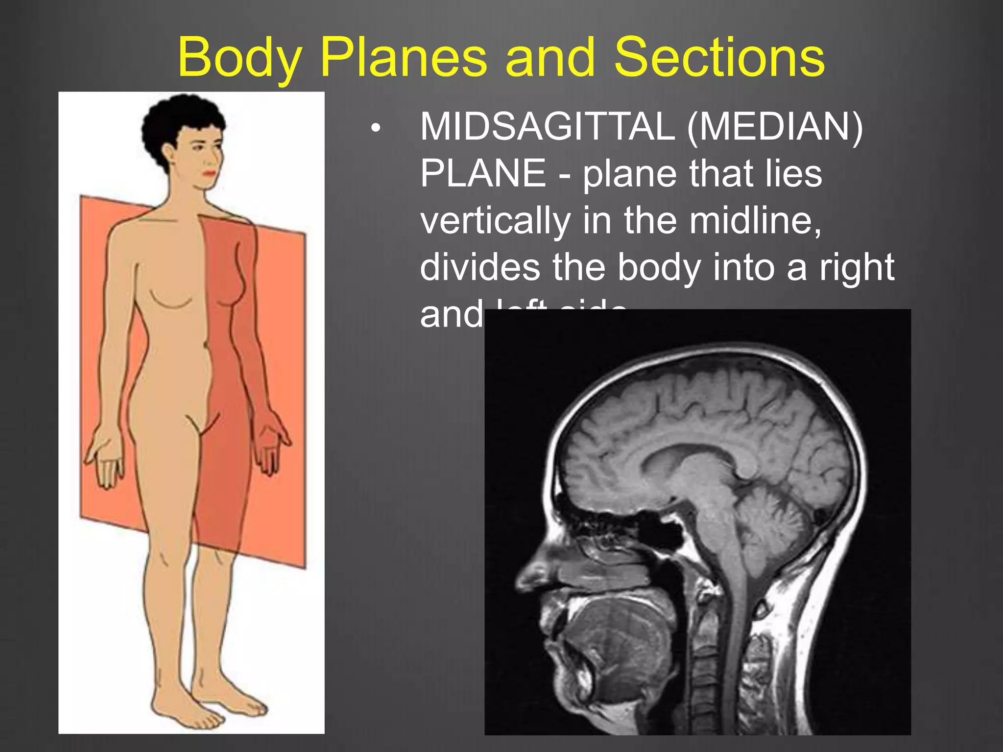 Body Planes and Sections
• MIDSAGITTAL (MEDIAN)
PLANE - plane that lies
vertically in the midline,
divides the body into a right
and left side.
 