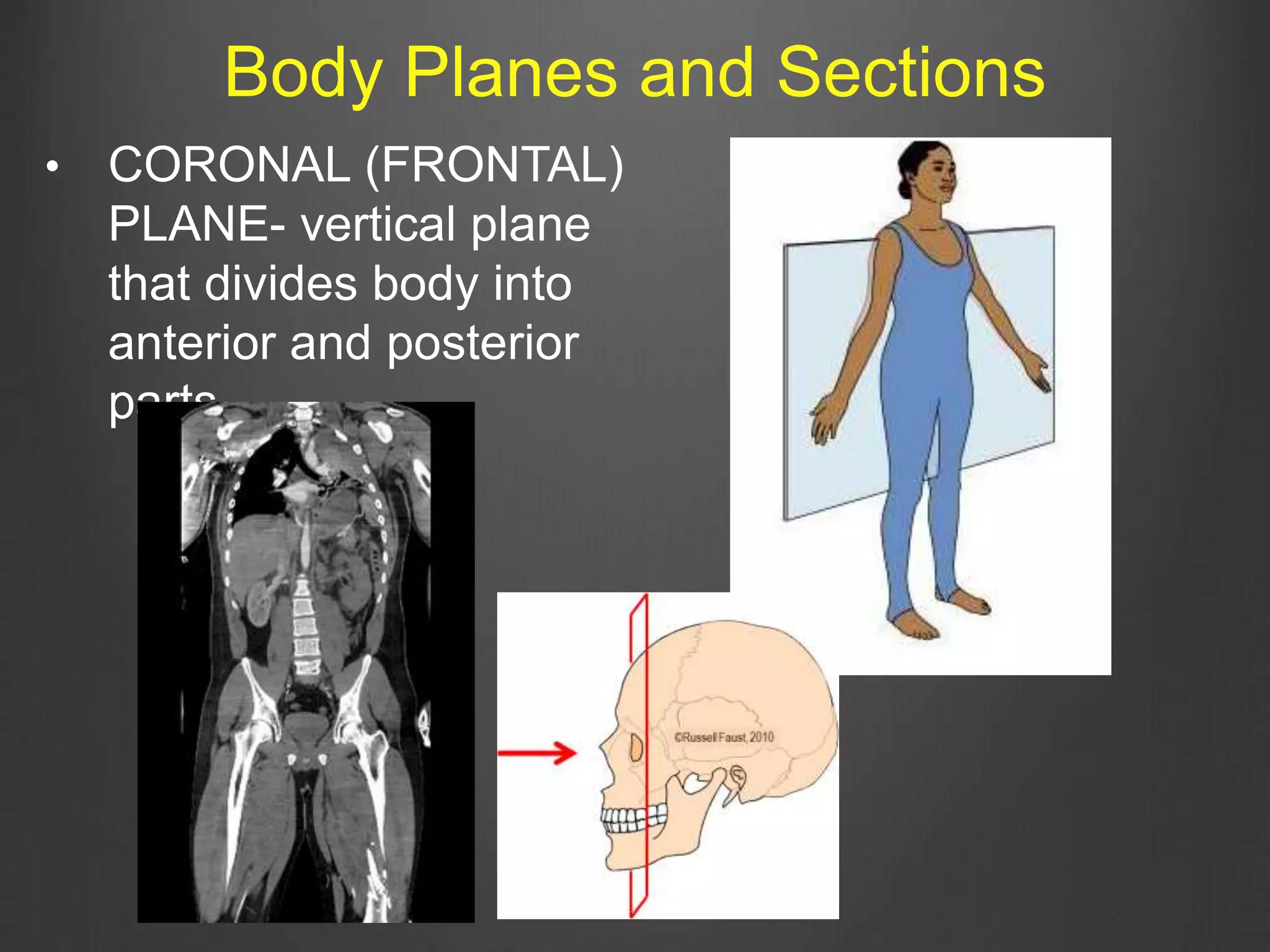 • CORONAL (FRONTAL)
PLANE- vertical plane
that divides body into
anterior and posterior
parts
Body Planes and Sections
 