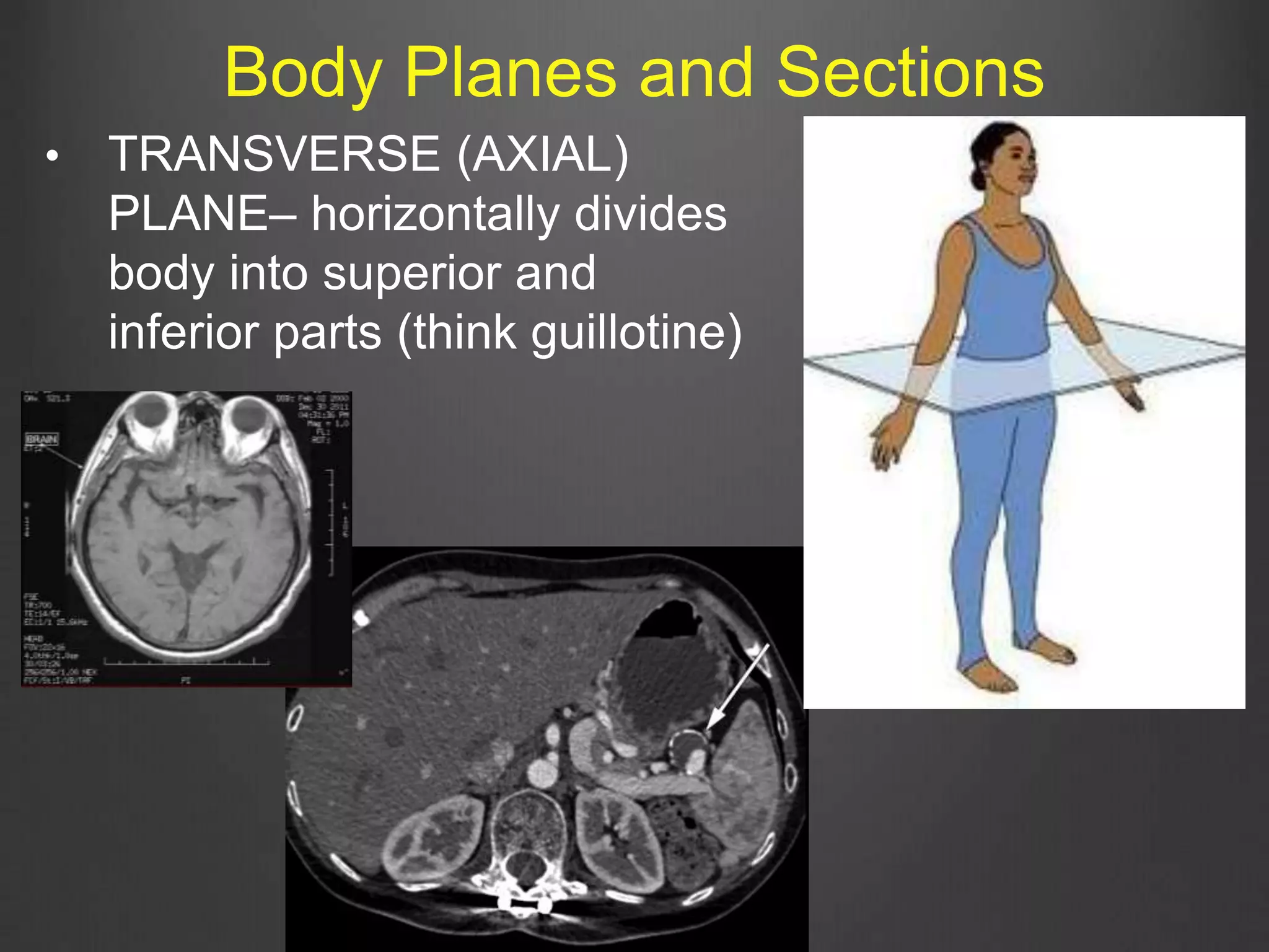 • TRANSVERSE (AXIAL)
PLANE– horizontally divides
body into superior and
inferior parts (think guillotine)
Body Planes and Sections
 