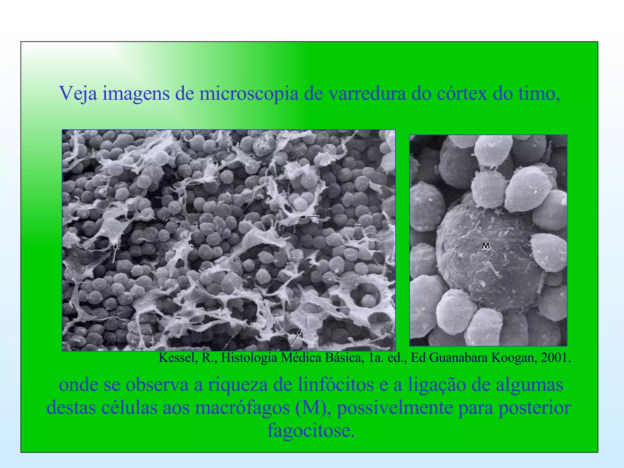 Veja imagens de microscopia de varredura do córtex do timo, onde se observa a riqueza de linfócitos e a ligação de algumas destas células aos macrófagos (M), possivelmente para posterior  fagocitose.  Kessel, R., Histologia Médica Básica, 1a. ed., Ed Guanabara Koogan, 2001. 