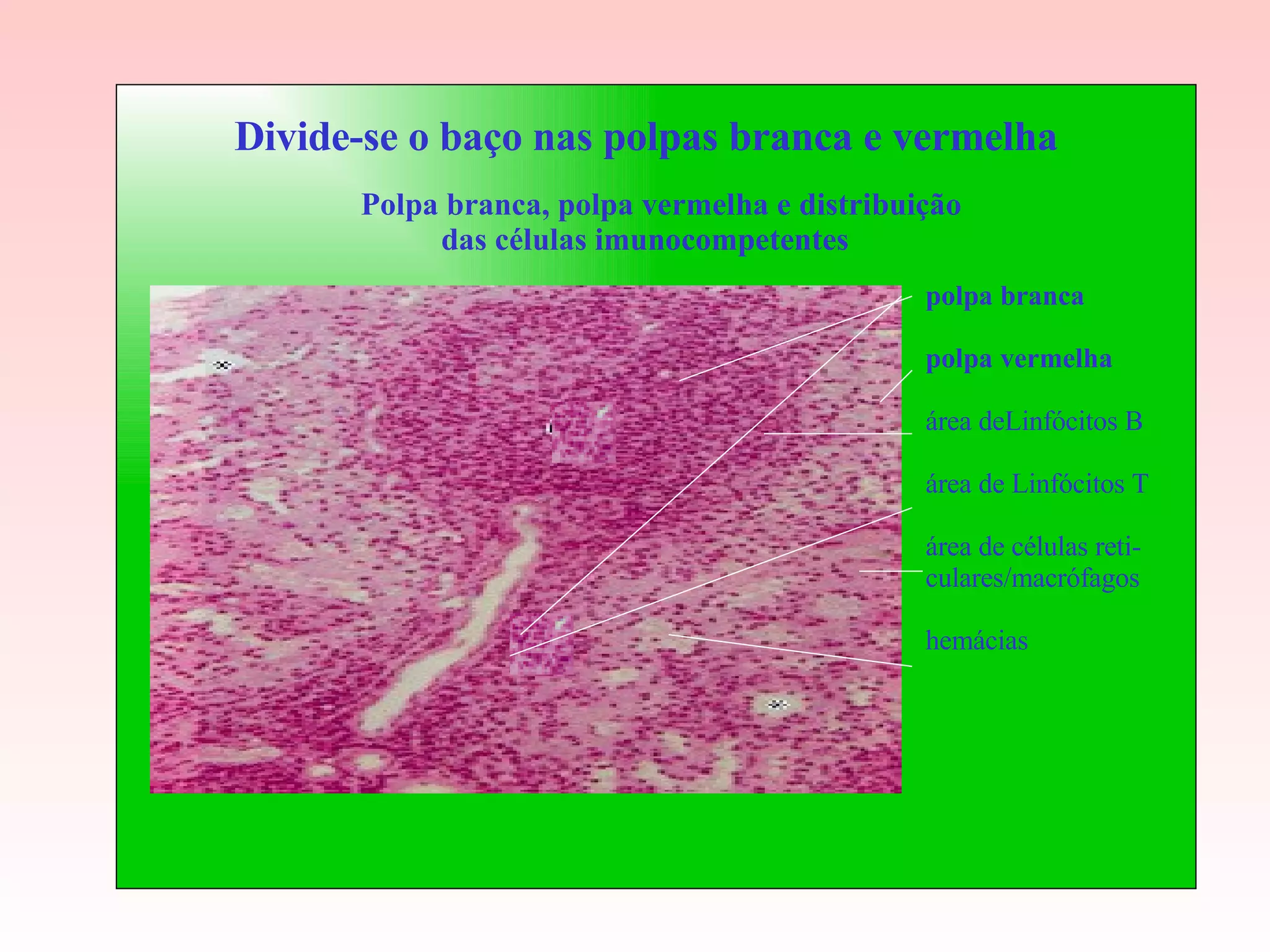 Polpa branca, polpa vermelha e distribuição das células imunocompetentes Divide-se o baço nas polpas branca e vermelha polpa branca polpa vermelha área deLinfócitos B área de Linfócitos T área de células reti- culares/macrófagos hemácias 