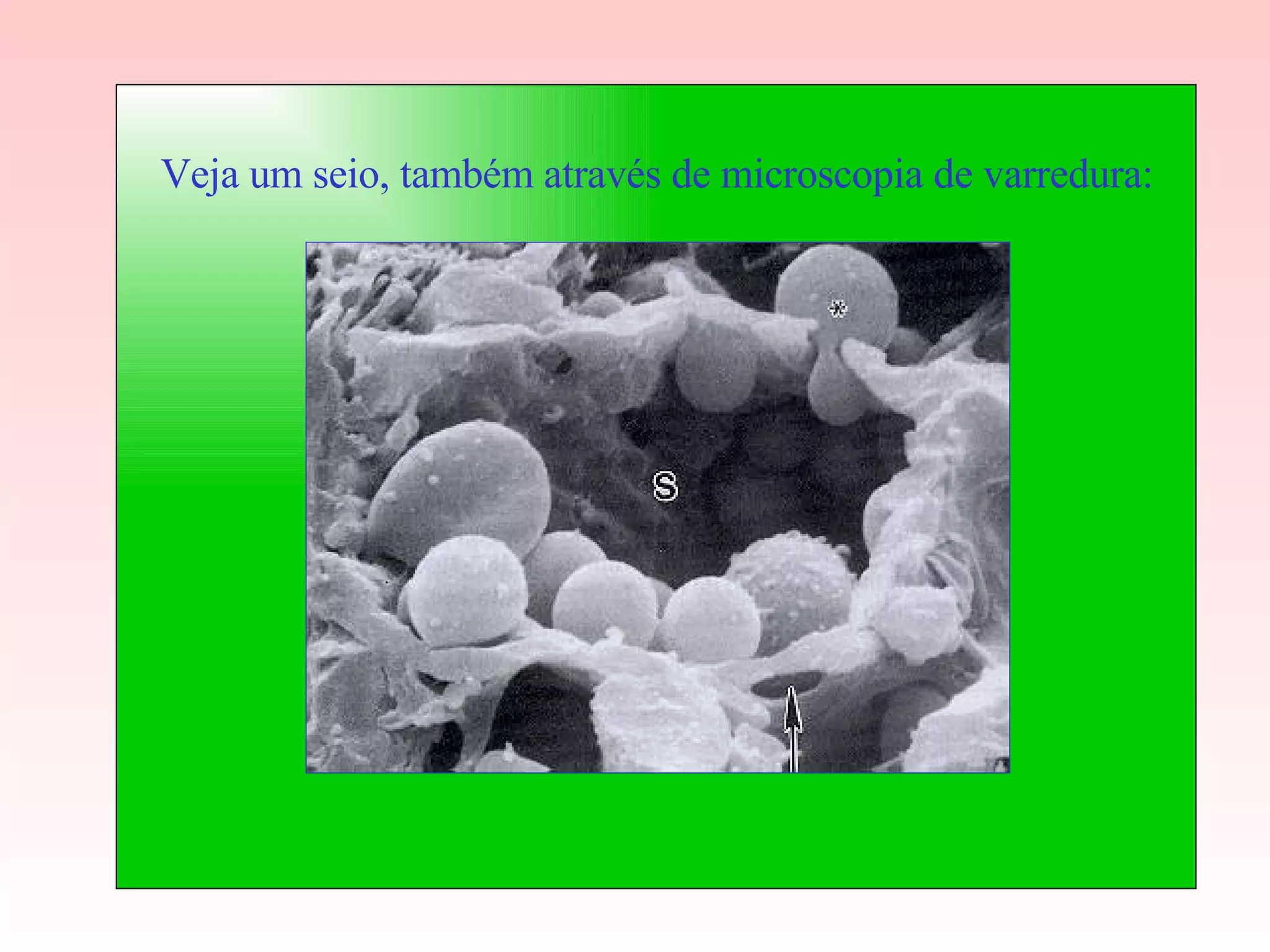 Veja um seio, também através de microscopia de varredura: 