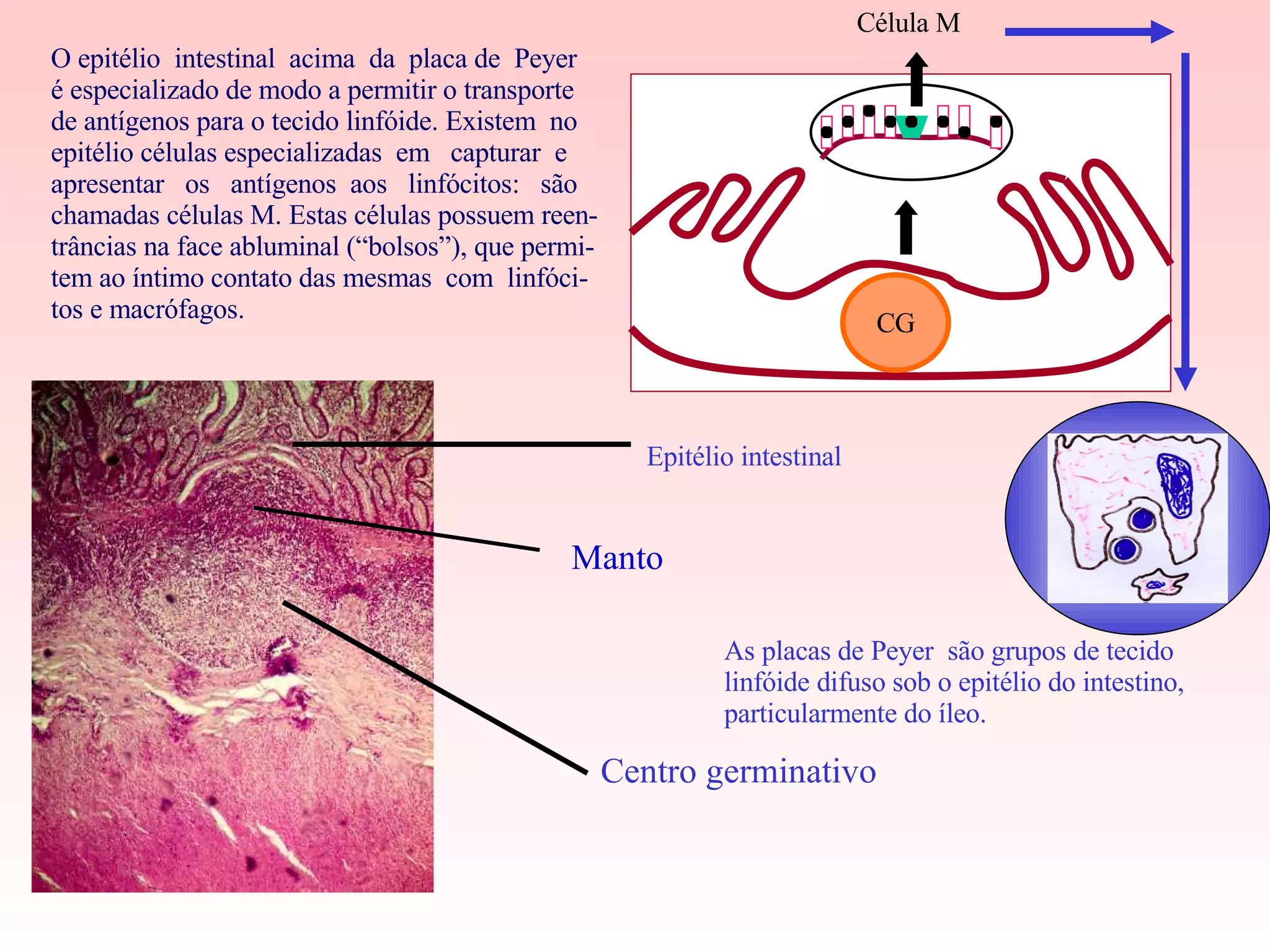 O epitélio  intestinal  acima  da  placa de  Peyer  é especializado de modo a permitir o transporte  de antígenos para o tecido linfóide. Existem  no epitélio células especializadas  em  capturar  e  apresentar  os  antígenos  aos  linfócitos:  são  chamadas células M. Estas células possuem reen- trâncias na face abluminal (“bolsos”), que permi- tem ao íntimo contato das mesmas  com  linfóci-tos e macrófagos. As placas de Peyer  são grupos de tecido  linfóide difuso sob o epitélio do intestino, particularmente do íleo. Centro germinativo Epitélio intestinal Célula M CG Manto 