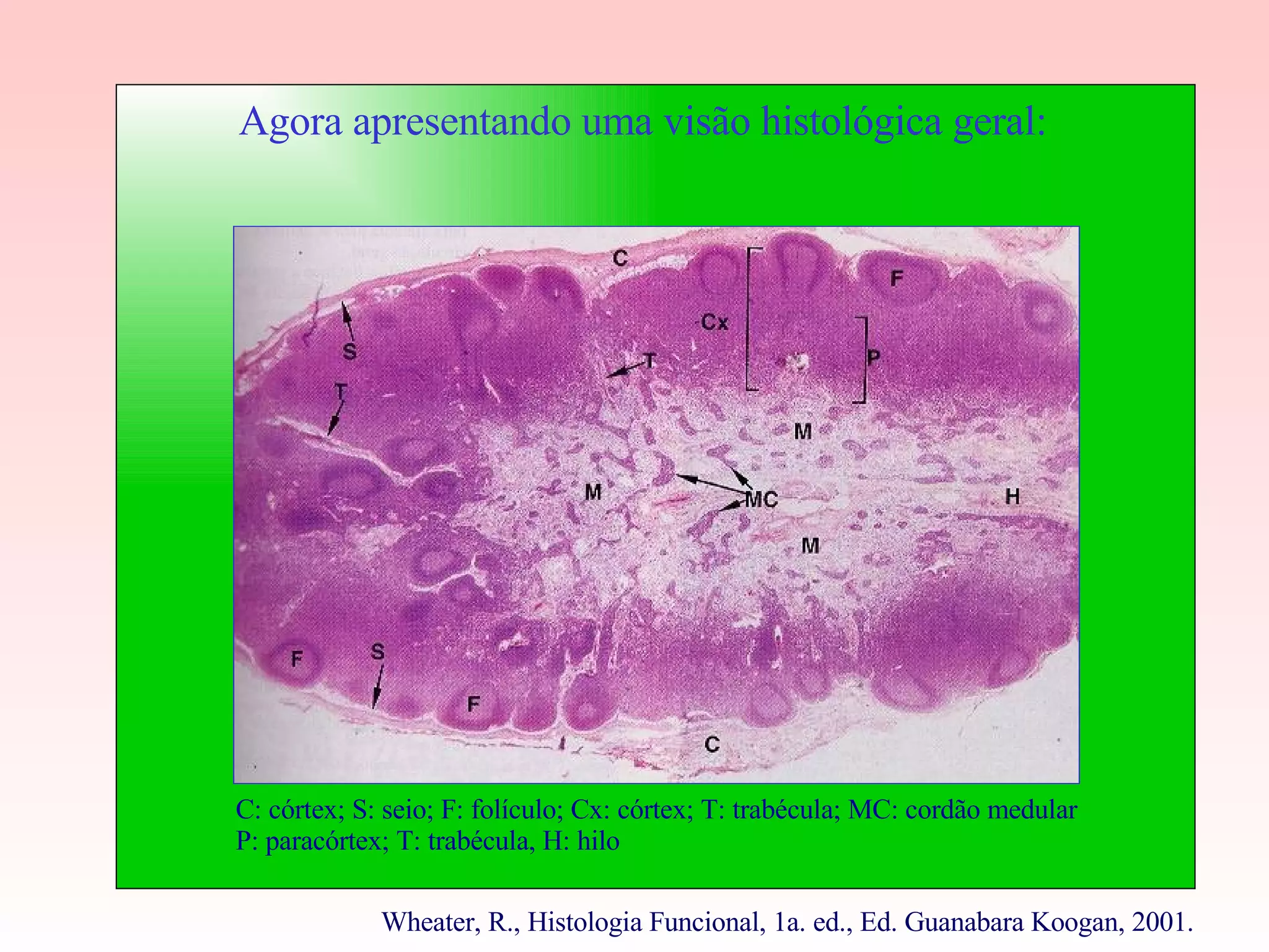 Agora apresentando uma visão histológica geral: C: córtex; S: seio; F: folículo; Cx: córtex; T: trabécula; MC: cordão medular P: paracórtex; T: trabécula, H: hilo Wheater, R., Histologia Funcional, 1a. ed., Ed. Guanabara Koogan, 2001.  