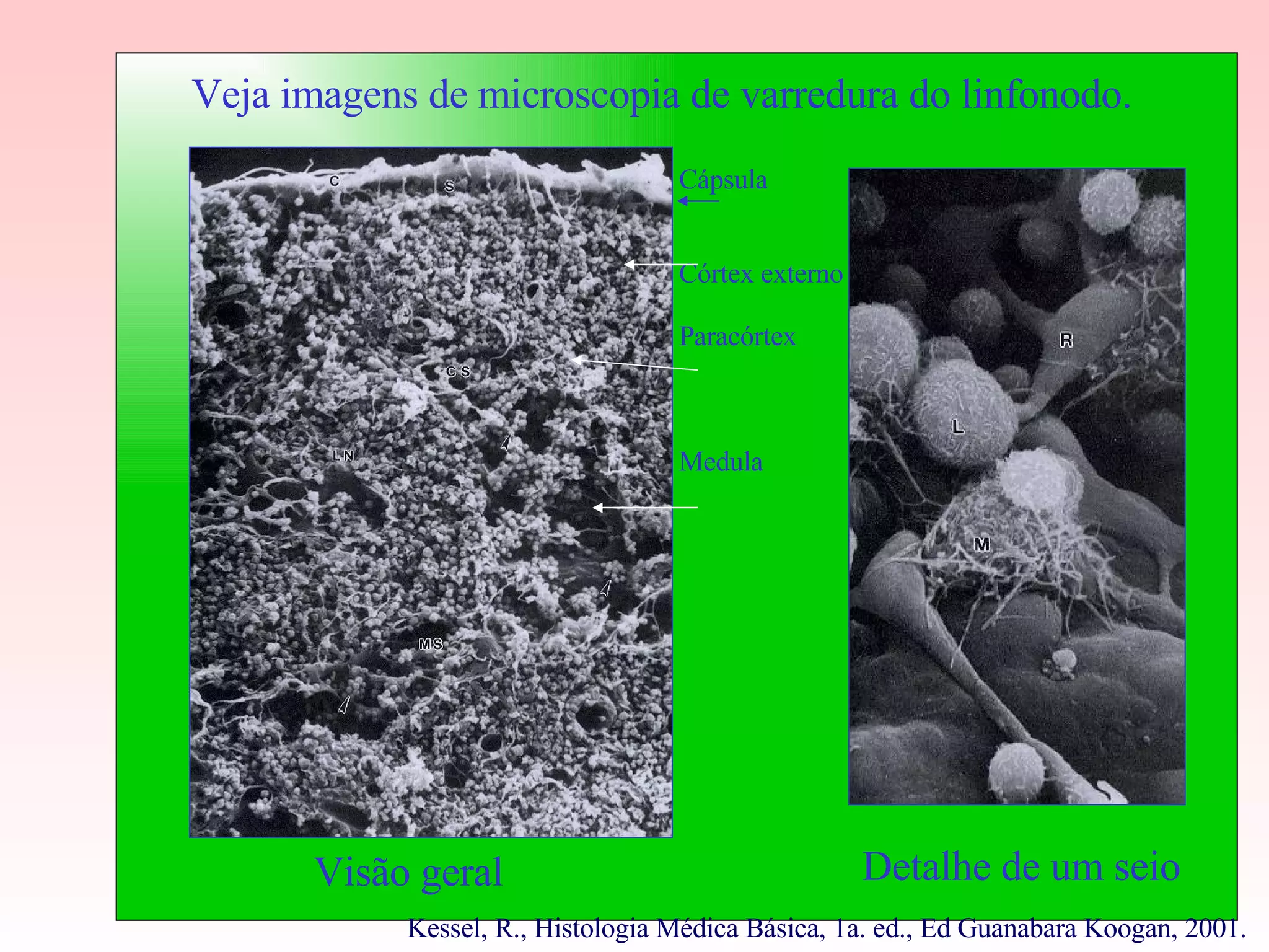 Veja imagens de microscopia de varredura do linfonodo. Visão geral Detalhe de um seio Cápsula Córtex externo Paracórtex Medula Kessel, R., Histologia Médica Básica, 1a. ed., Ed Guanabara Koogan, 2001. 