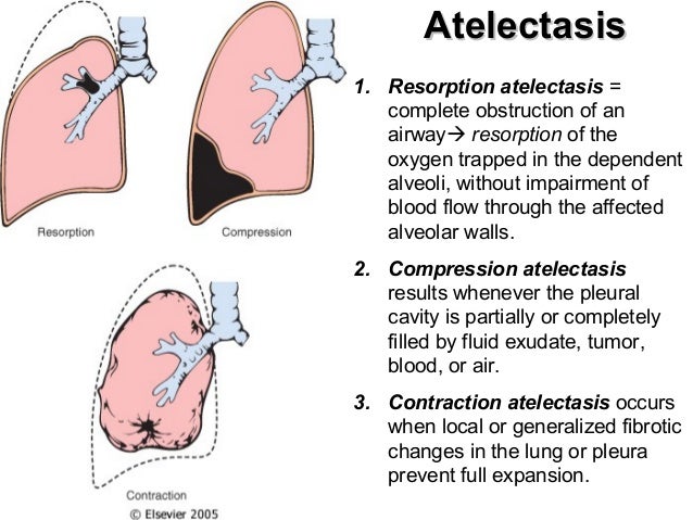 Ap 50 10-29 1 pathology of lung 1