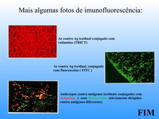 Ac contra Ag tecidual conjugado com  rodamina (TRICT) Ac contra Ag tecidual, conjugado com fluoresceína ( FITC ) Anticorpos contra antígenos teciduais conjugados com rodamina   e  com  fluoresceína   (obviamente dirigidos contra antígenos diferentes). Mais algumas fotos de imunofluorescência: FIM 