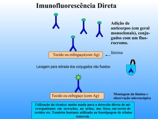 Imunofluorescência Direta   Lavagem para retirada dos conjugados não fixados:  Adição de anticorpos (em geral monoclonais), conju- gados com um fluo- rocromo. lâmina Montagem da lâmina e  observação microscópica Utilização da técnica: muito usada para a detecção direta de mi- crorganismos  em  secreções,  na  urina,  nas  fezes, em cortes de tecidos etc. Também bastante utilizada na fenotipagem de células tumorais  Tecido ou esfregaço(com Ag) Tecido ou esfregaço (com Ag) 