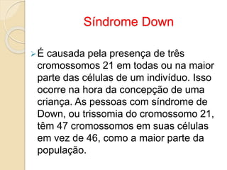 Síndrome Down
É causada pela presença de três
cromossomos 21 em todas ou na maior
parte das células de um indivíduo. Isso
ocorre na hora da concepção de uma
criança. As pessoas com síndrome de
Down, ou trissomia do cromossomo 21,
têm 47 cromossomos em suas células
em vez de 46, como a maior parte da
população.
 