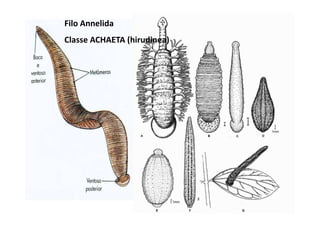 Filo Annelida
Classe ACHAETA (hirudinea)
 