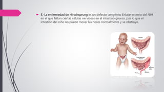  5.-La enfermedad de Hirschsprung es un defecto congénito Enlace externo del NIH
en el que faltan ciertas células nerviosas en el intestino grueso, por lo que el
intestino del niño no puede mover las heces normalmente y se obstruye.
 