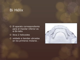 Bi Hélix
 El aparato correspondiente
para el maxilar inferior es
el Bi-hélix
 lleva 2 helicoides
 soldado a bandas ubicadas
en los primeros molares .
 