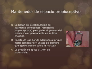 Mantenedor de espacio propioceptivo
 Se basan en la estimulación del
ligamento periodontal (receptores
propioceptivos) para guiar al germen del
primer molar permanente en su libre
erupción.
 Consta de una banda adaptada al primer
molar temporario y un asa de alambre
que ejerce presión sobre la mucosa.
 La presión se aplica a 1mm de
profundidad.
 