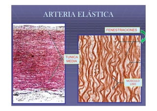 ARTERIA ELÁSTICA
              FENESTRACIONES




     TUNICA
     MEDIA




                       MÚSCULO
                         LISO
 