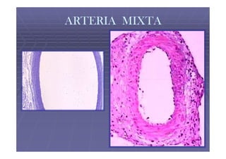 ARTERIA MIXTA
 