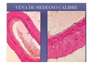VENA DE MEDIANO CALIBRE
 
