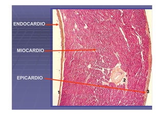 ENDOCARDIO




 MIOCARDIO




 EPICARDIO
 