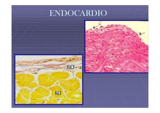 ENDOCARDIO
 