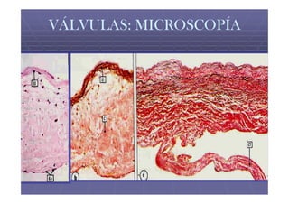 VÁLVULAS: MICROSCOPÍA
 