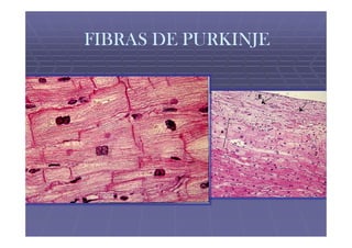 FIBRAS DE PURKINJE
 
