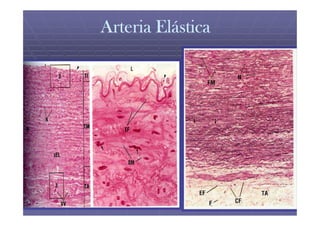 Arteria Elástica
 