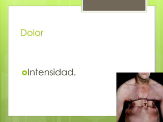 Dolor
Intensidad.
 