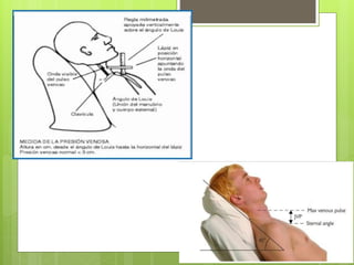 Presión venosa
 