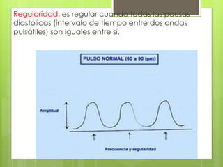 Regularidad: es regular cuando todas las pausas
diastólicas (intervalo de tiempo entre dos ondas
pulsátiles) son iguales entre sí.
 