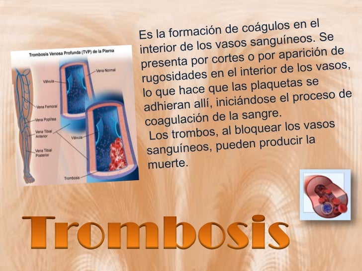 Enfermedades del Aparato Circulatorio en el ser humano.