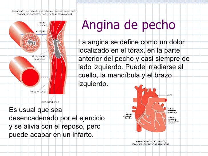 El dolor vivo en el pecho derecho el pecho es aumentado
