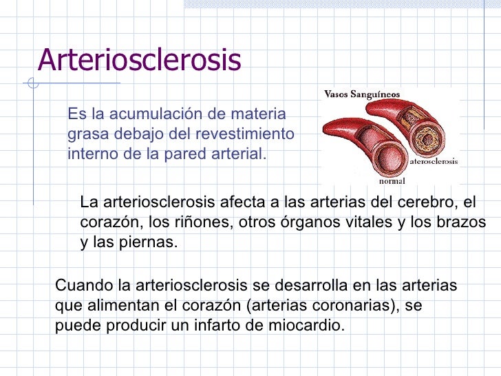Lfk la osteocondrosis pilleando los sacos de viaje