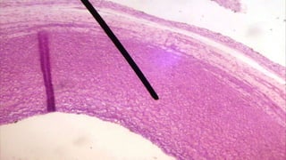 Histología Vascular (leeson)