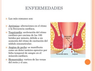 ENFERMEDADES
 Las más comunes son:
 Arritmias: alteraciones en el ritmo
o la frecuencia cardíaca.
 Taquicardia: aceleración del ritmo
cardíaco por encima de los 100
latidos por minuto, debido a un
aumento del ritmo de excitación del
nódulo sinoauricular.
 Angina de pecho: se manifiesta
como un dolor torácico opresivo por
falta temporal de sangre en el
músculo cardíaco.
 Hemorroides: varices de las venas
del recto y el ano.
 